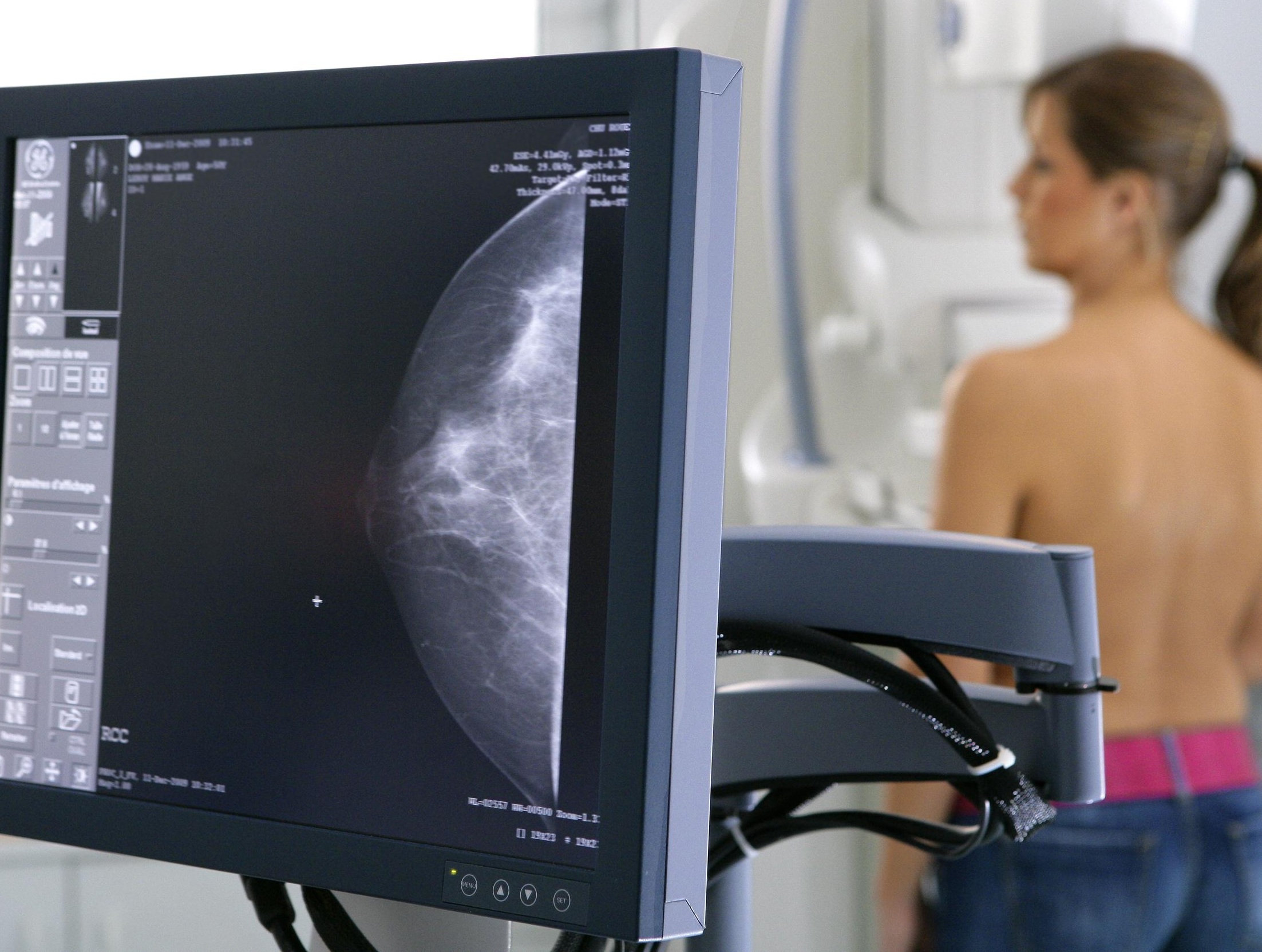 Маммография - метод скрининга молочных желез